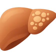 Alcoholic and Non-alcoholic Fatty Liver Disease