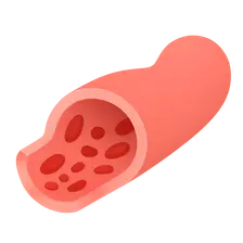 Acute tubular necrosis