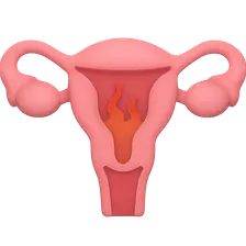 Primary Dysmenorrhea