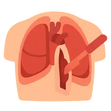 Resuscitative thoracotomy