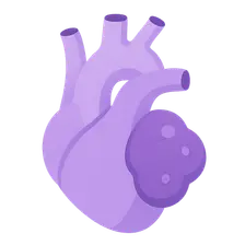 Paragangliomas