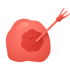 Tumor Ablation Techniques