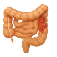Drugs for Inflammatory Bowel Disease