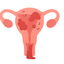 Complications of Abortion