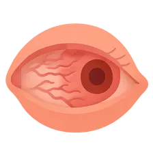 Cicatricial Conjunctival Disorders