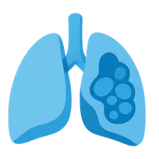 Congenital Lung Malformations