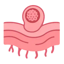 Implantation