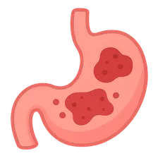 Intra-abdominal Infections