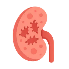 Pyelonephritis and urinary tract infections