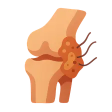 Fungal and Parasitic Infections