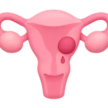 Menstrual Disorders