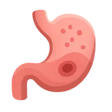 Gastritis and peptic ulcer disease