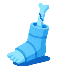 Post-Fracture Rehabilitation