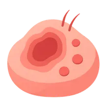 Cytomegalovirus Cutaneous Manifestations