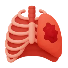 Chest Trauma Imaging
