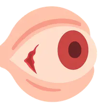 Scleral Trauma