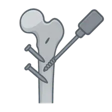 Minimally Invasive Orthopaedic Surgery