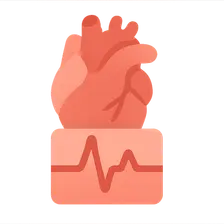 ECG interpretation in MI
