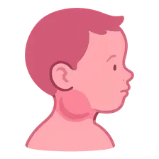 Pediatric Head and Neck Masses