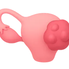 Ovarian Cancer