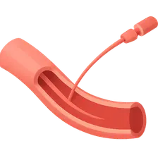 Vascular Access Techniques