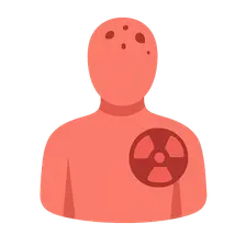 Acute Radiation Syndrome