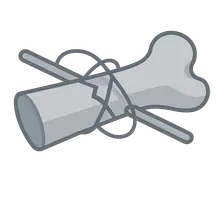 Tension Band Wiring