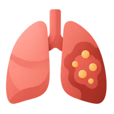 Hospital-Acquired Complications