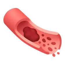 Thrombolytic Agents