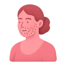 Hirsutism and Virilization
