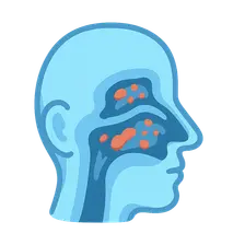 Chronic Rhinosinusitis