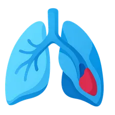 V/Q mismatch in pulmonary embolism