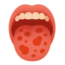 Oral Manifestations of Systemic Diseases