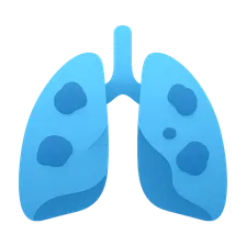 Occupational Lung Diseases