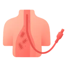 Central line-associated bloodstream infections
