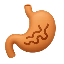 GI motility disorders