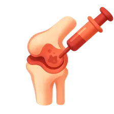 Management of Joint Infections