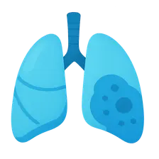 Pulmonary Complications