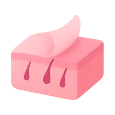 Chemical Peels