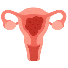 Postpartum Complications