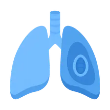 Obstructive Airway Diseases (Asthma, COPD)