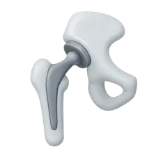 Total Hip Arthroplasty