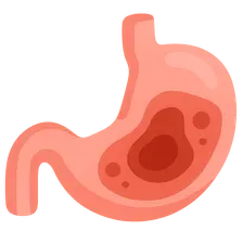 Intra-abdominal infections