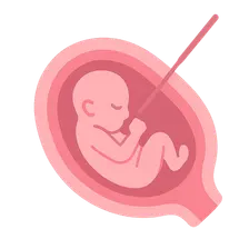 Intrauterine Fetal Therapy