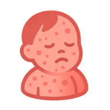 Late-onset sepsis