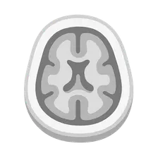 MRI Anatomy