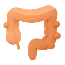 Diverticular disease