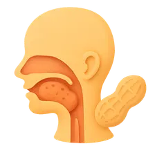 Food Allergies and the Upper Aerodigestive Tract