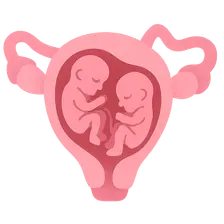 Multiple gestation management