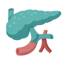 Pancreas Transplantation